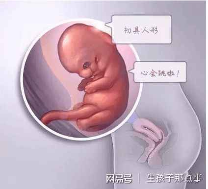 多囊卵巢案例