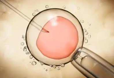 单身试管供卵服务公司试管婴儿中心